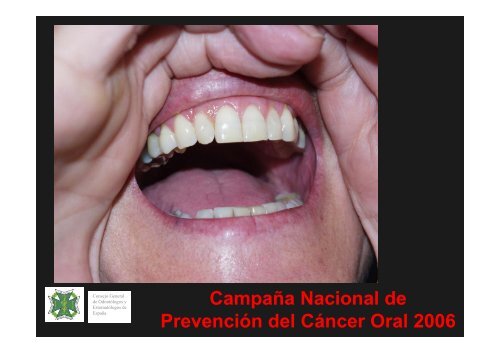 Curso Diagnóstico precoz del cáncer oral.