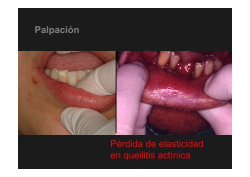 Curso Diagnóstico precoz del cáncer oral.