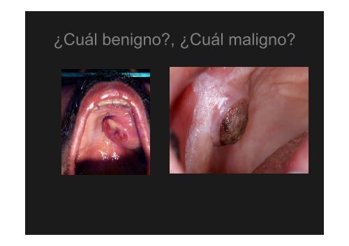 Curso Diagnóstico precoz del cáncer oral.