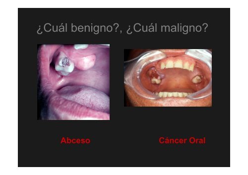 Curso Diagnóstico precoz del cáncer oral.