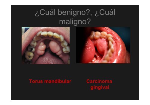 Curso Diagnóstico precoz del cáncer oral.