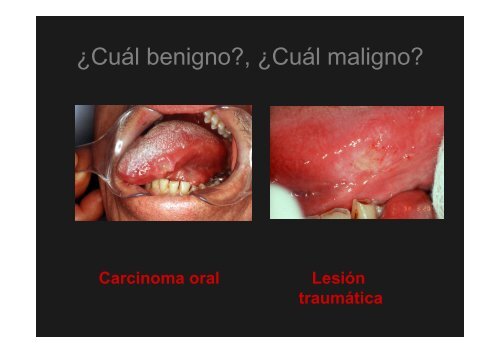 Curso Diagnóstico precoz del cáncer oral.