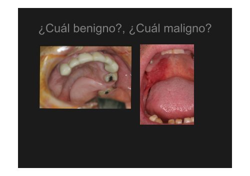 Curso Diagnóstico precoz del cáncer oral.