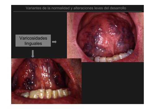 Curso Diagnóstico precoz del cáncer oral.