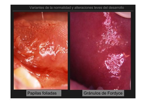 Curso Diagnóstico precoz del cáncer oral.