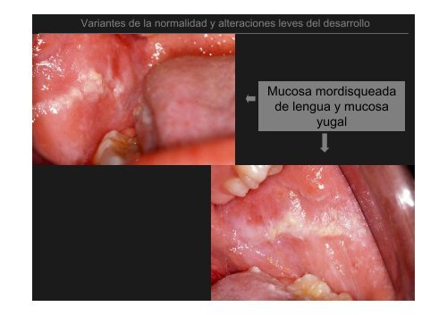 Curso Diagnóstico precoz del cáncer oral.