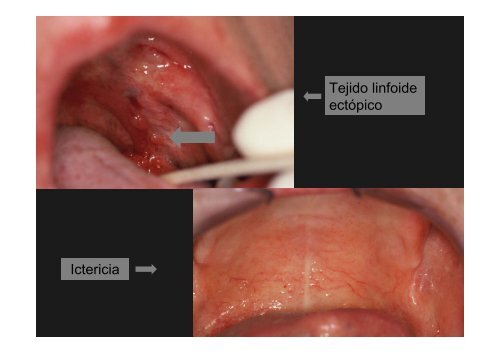 Curso Diagnóstico precoz del cáncer oral.