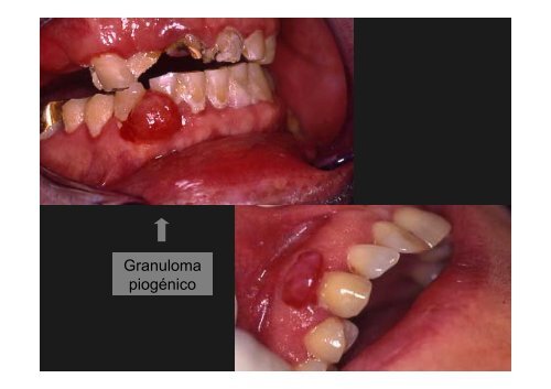 Curso Diagnóstico precoz del cáncer oral.