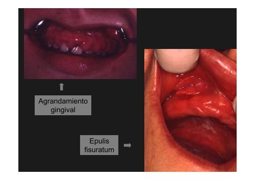 Curso Diagnóstico precoz del cáncer oral.