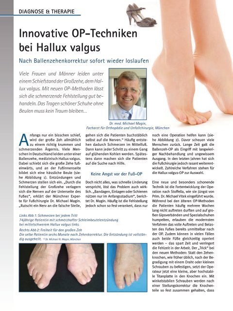 Innovative Op Techniken Bei Hallux Valgus Magin Dr Med