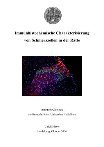 Immunhistochemische Charakterisierung von Schmerzzellen in der ...