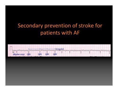 Acute ischemic stroke treatment in a nutshell