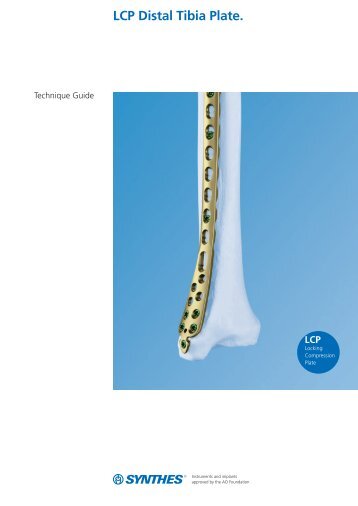 LCP Distal Tibia Plate. - Osteosyntese