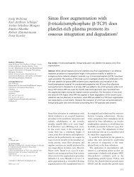 platelet-rich plasma..