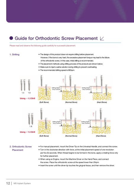 Orthodontic Screw System Orthodontic Screw System - Osstem.