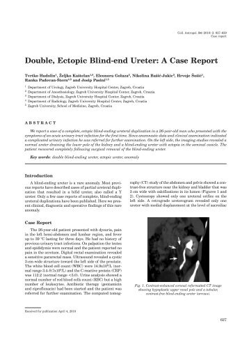 Double, Ectopic Blind-end Ureter