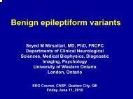 Benign epileptiform variants - Canadian Neurological Sciences ...