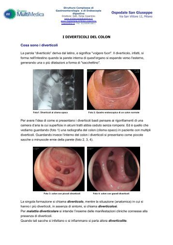 Diverticoli e complicanze (agg. 2012) - EndoscopiaDigestiva.it