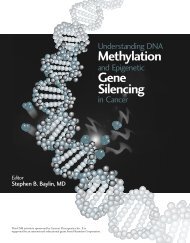Understanding DNA Methylation Gene Silencing