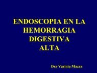 Endoscopia en la hemorragia digestiva alta. - Asociación de ...