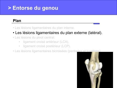 Entorse du genou - bienvenue sur le site de l'amiform