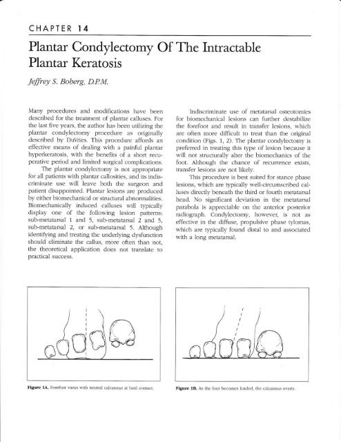 Plantar Condylectomy Of The Intractable - The Podiatry Institute