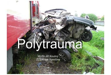 Polytrauma - AKUTNE.CZ