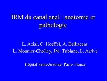 IRM du canal anal : anatomie et pathologie