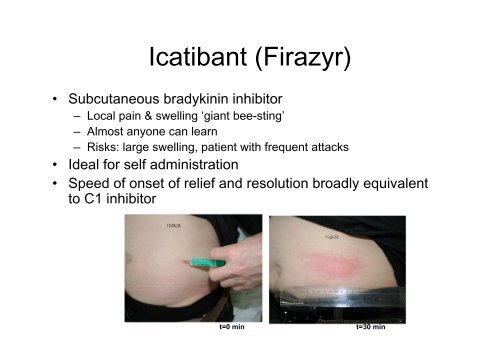 Current issues in Hereditary Angioedema (HAE) - Ipopi