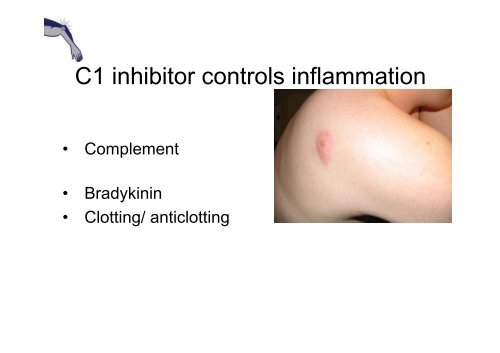 Current issues in Hereditary Angioedema (HAE) - Ipopi