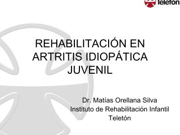 RehabilitaciÃ³n en artritis idiopÃ¡tica juvenil