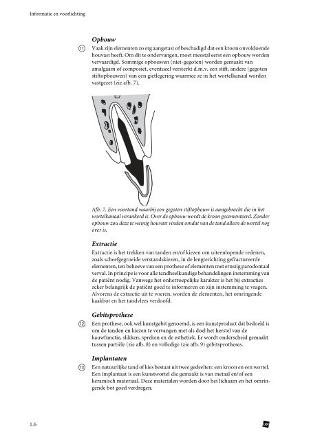 Algemene informatie en voorlichting geven na extractie