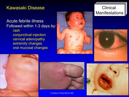 Vasculitis - Langford.pdf - AInotes