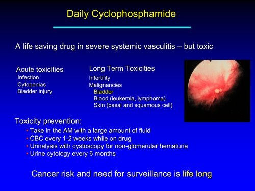 Vasculitis - Langford.pdf - AInotes