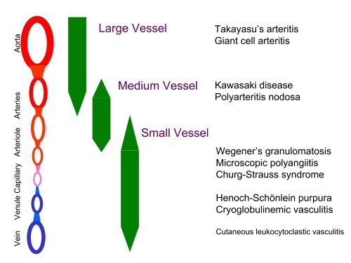 Vasculitis - Langford.pdf - AInotes