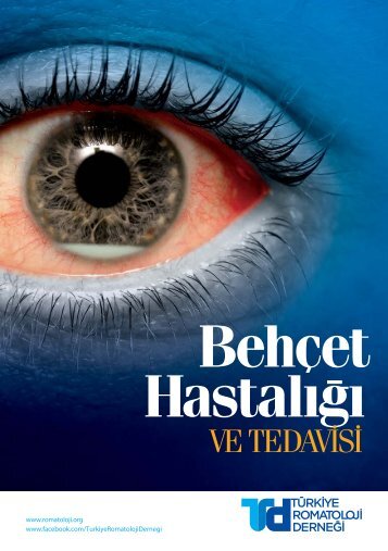 TRD-BEHCET_Hastalığı_ve_Tedavisi