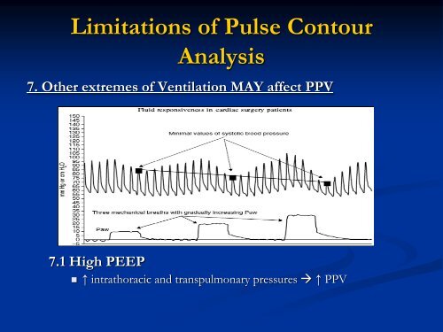 Invasive Cardiac Output Monitoring and Pulse Contour Analysis