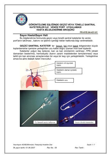 Görüntüleme Eşliğinde Geçici veya Tünelli Santral Kateterler İle ...