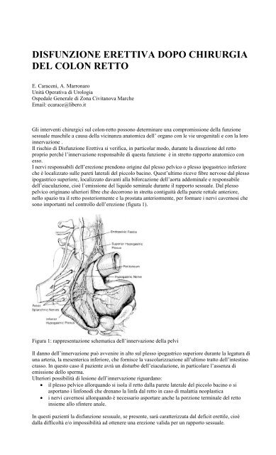 disfunzione erettile dopo chirurgia del cancro del colon-retto