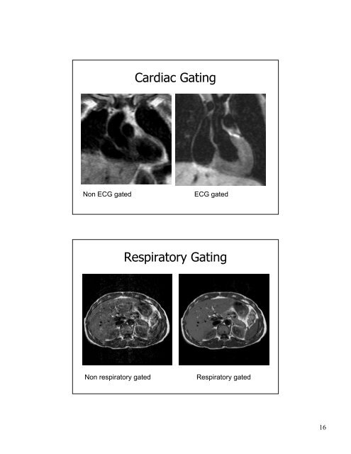 MRI EQUIPMENT Essentials