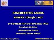 pancreatitis aguda pancreatitis aguda - Reeme.arizona.edu