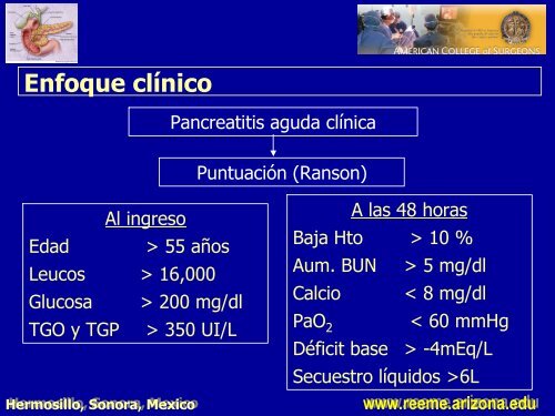 pancreatitis aguda pancreatitis aguda - Reeme.arizona.edu