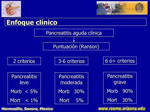 pancreatitis aguda pancreatitis aguda - Reeme.arizona.edu