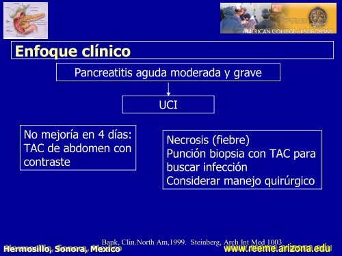 pancreatitis aguda pancreatitis aguda - Reeme.arizona.edu