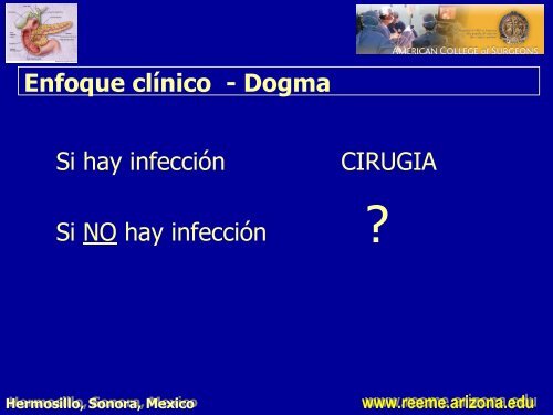 pancreatitis aguda pancreatitis aguda - Reeme.arizona.edu