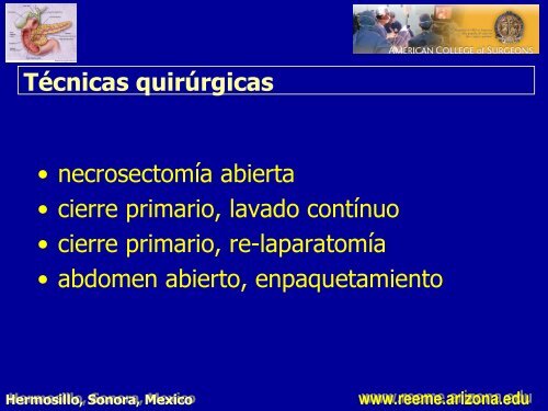 pancreatitis aguda pancreatitis aguda - Reeme.arizona.edu