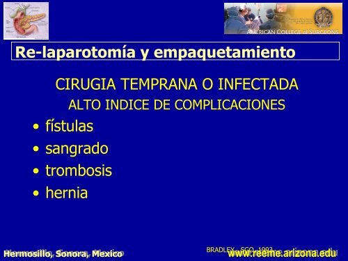 pancreatitis aguda pancreatitis aguda - Reeme.arizona.edu