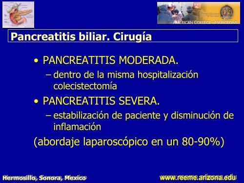 pancreatitis aguda pancreatitis aguda - Reeme.arizona.edu