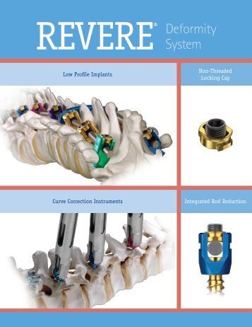 REVERE® Deformity System - Pages