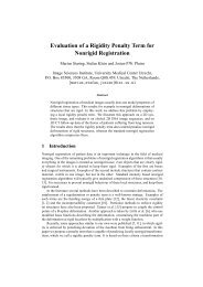 Evaluation of a Rigidity Penalty Term for Nonrigid Registration - elastix